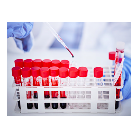 [CY] Cytological analysis
